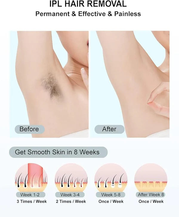 BabyVerse Professional IPL Laser Permanent Hair Removal