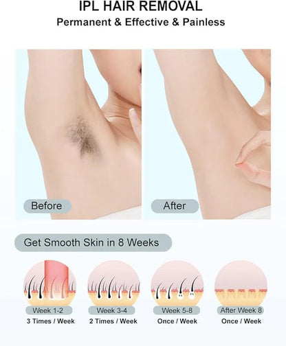 BabyVerse Professional IPL Laser Permanent Hair Removal